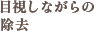 目視しながらの除去