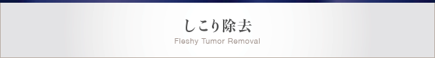 しこり除去