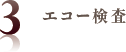 エコー検査