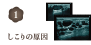 しこりの原因