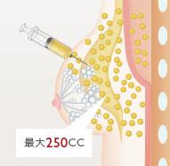 注入量 最大250CC