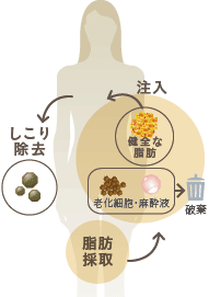 脂肪採取からしこり除去までの流れ イメージ
