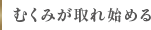 むくみが取れ始める
