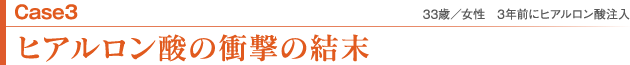 case3 ヒアルロン酸の衝撃の結末 33歳／女性　3年前にヒアルロン酸注入
