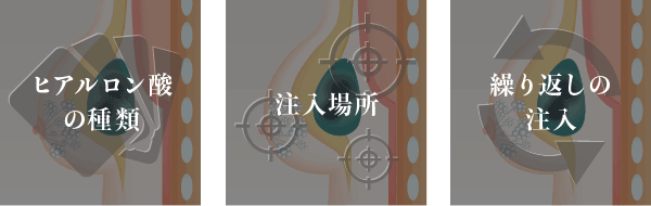 その他、ヒアルロン酸の種類や注入場所、繰り返しの注入なども原因として考えられます。