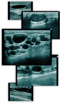 手軽な反面、陥りがちなしこりトラブル