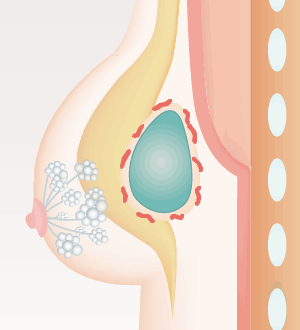 体内の酵素が少しずつ分解