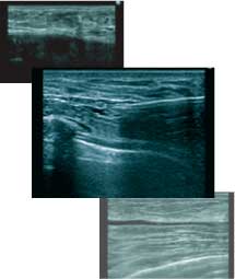 術後もエコーで確認