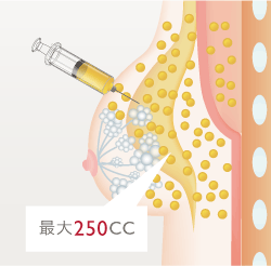 最大2500CC